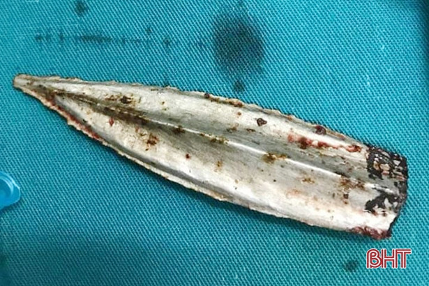 Rơi từ độ cao 4m, nam trung niên bị mảnh kim khí dài 7cm cắm vào khuỷu tay