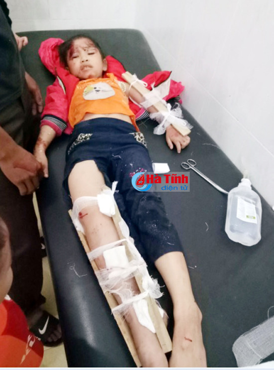 tngt nghiem trong 3 me con thuong vong 1 be gai bi thuong nang