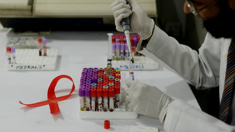 cac nha nghien cuu cuba thu nghiem vac xin dieu tri hiv aids