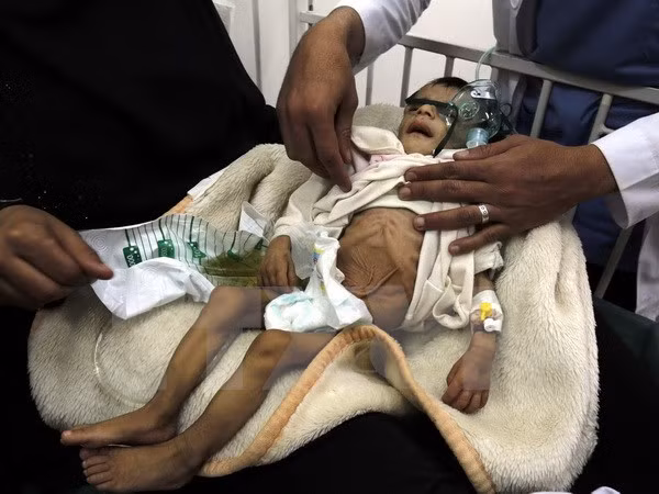 nan doi de doa tinh mang cua hang trieu tre em o chau phi