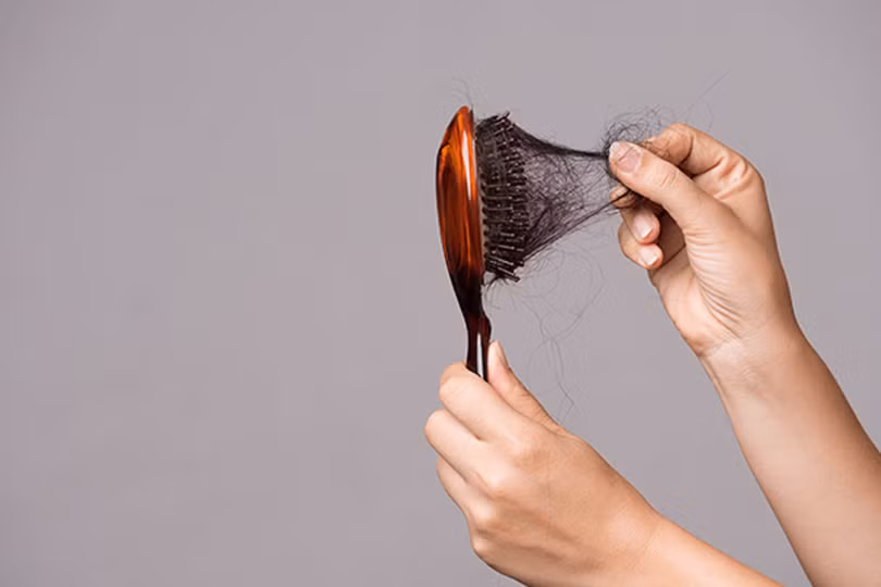 Stress không chỉ là cảm giác mệt mỏi mà khiến tóc rụng nhiều, mỏng đi nhanh chóng.