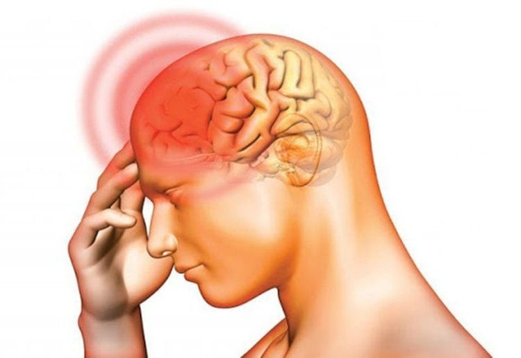 Viêm màng não là tình trạng nhiễm trùng lớp màng bao phủ não và tủy sống do liên cầu khuẩn lợn gây ra Viêm màng não là tình trạng nhiễm trùng lớp màng bao phủ não và tủy sống do liên cầu khuẩn lợn gây ra