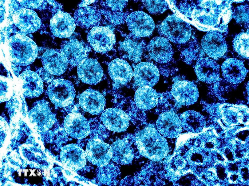 Virus SARS-CoV-2. (Ảnh: AFP/TTXVN)