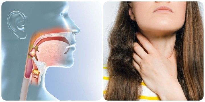 Nếu khối u phát triển xung quanh các dây thanh, sẽ dẫn đến việc thay đổi giọng nói. Nếu khối u phát triển xung quanh các dây thanh, sẽ dẫn đến việc thay đổi giọng nói.