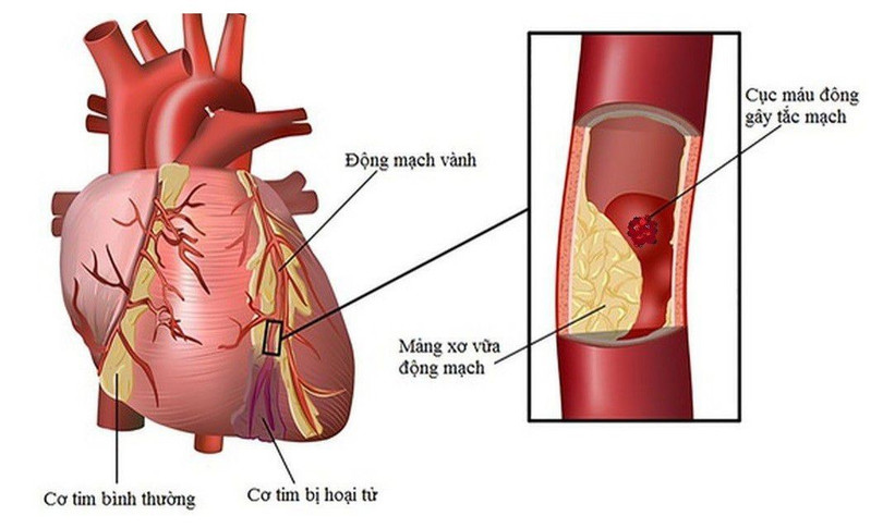 Vỏ chanh là một thành phần tiềm năng trong chế độ ăn tốt cho tim mạch.