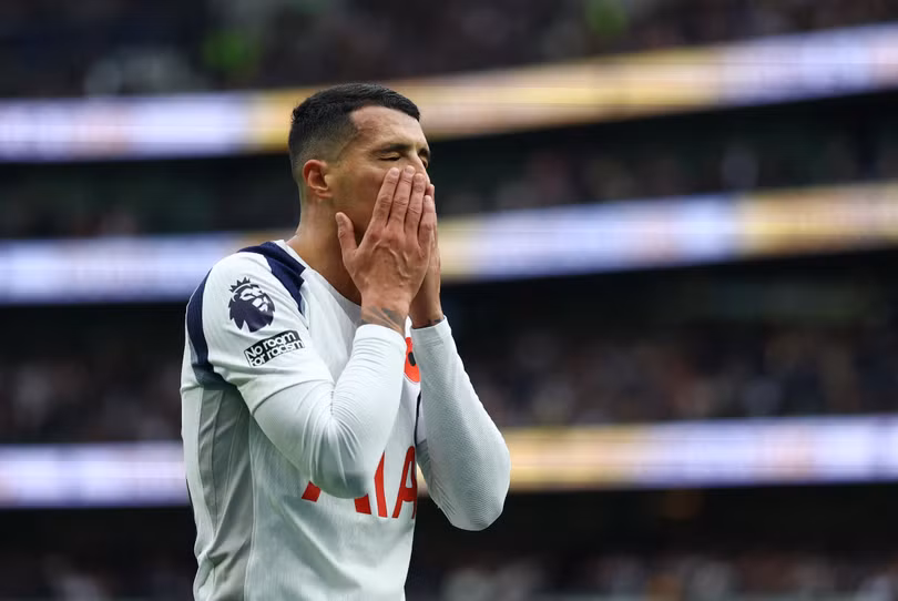 Bruno Fernandes có ngày thi đấu thiếu thuyết phục với nhiều pha chuyền hỏng.