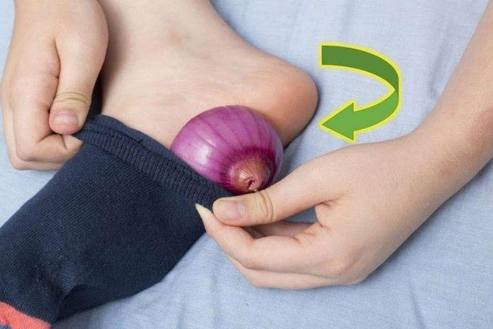 Ngoài việc làm gia vị, hành tây còn có những lợi ích cực hay