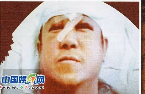 thanh long ly lien kiet bi thao tung den muc nao