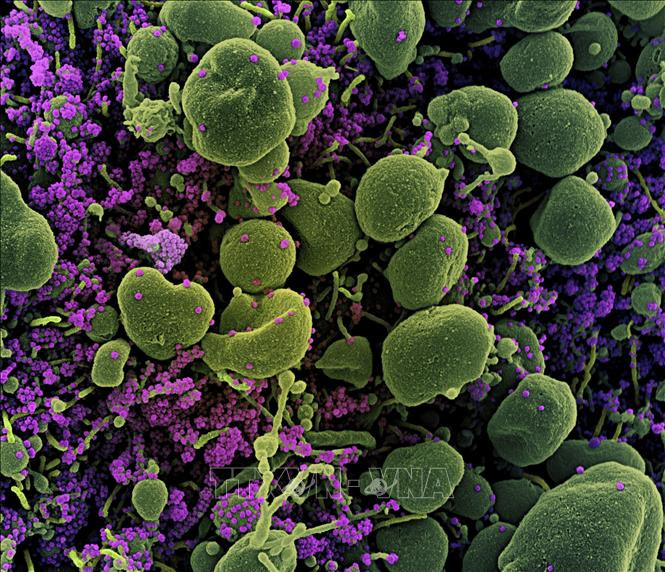 Bồ Đào Nha phát hiện 3 biến thể mới của virus SARS-CoV-2