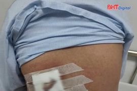 Đắp lá cây trị mụn nhọt, người phụ nữ nguy kịch hoại tử vùng lưng