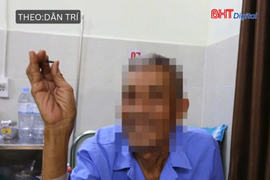Gắp đầu đạn tồn tại 60 năm trong cơ thể cựu chiến binh hơn 80 tuổi