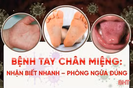 [Infographic] Bệnh tay chân miệng - nhận biết nhanh, phòng ngừa đúng