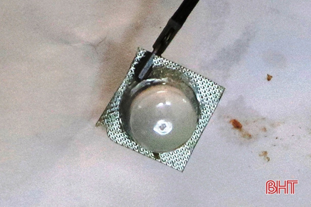 BVĐK Hà Tĩnh gắp viên thuốc nguyên vỉ sắc nhọn trong thực quản ông cụ 96 tuổi