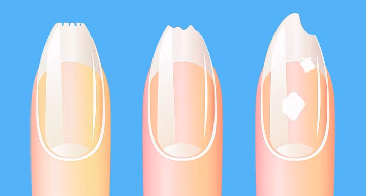 10 thay đổi cảnh báo tình trạng sức khỏe mà bạn cần chú ý