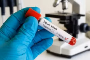 Bộ Y tế chỉ đạo khẩn ứng phó với bệnh do virus Ebola