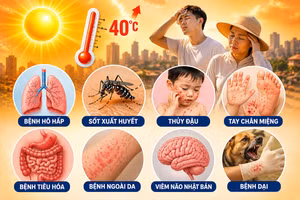Cảnh báo nhiều dịch bệnh có nguy cơ bùng phát trong mùa hè