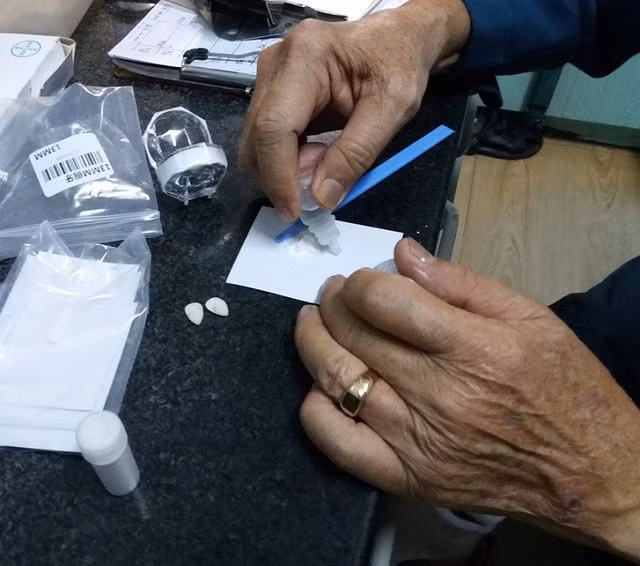 Mua răng... trên mạng, trào lưu làm đẹp nguy hiểm của giới trẻ