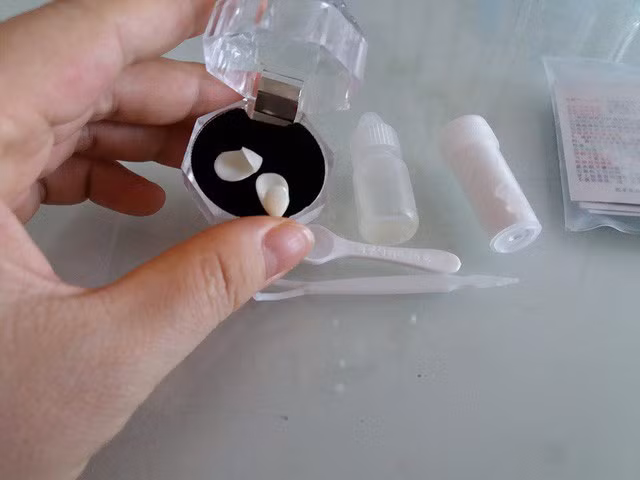 Mua răng... trên mạng, trào lưu làm đẹp nguy hiểm của giới trẻ