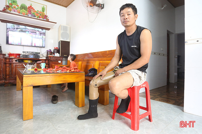 Sau vụ tai nạn lao động, anh Hoàng đã mất đi 2/3 chân phải. a2.jpg