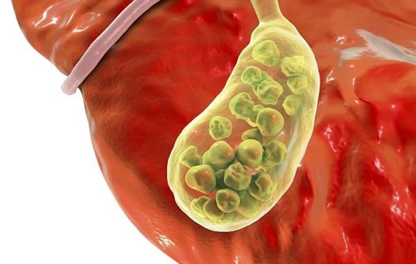 Kim Đởm Khang 6.jpg