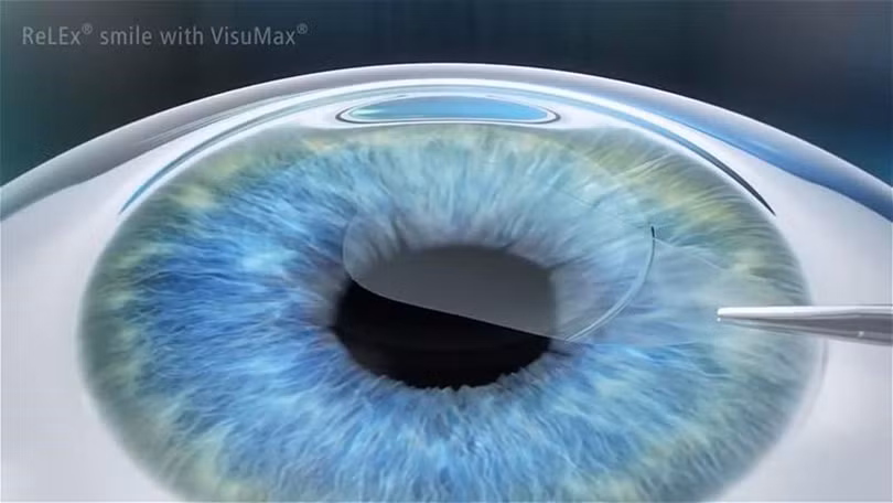 phẫu thuật 1.jpg