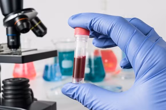 Xác định thêm 1 chủng virus HIV hoàn toàn mới