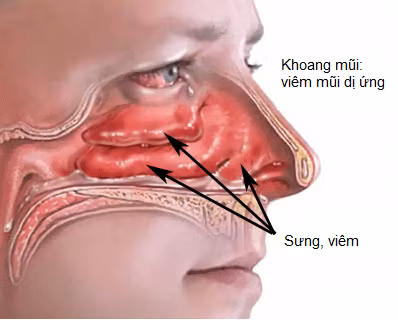 Mùa đông uống nước nóng - lợi ích lớn