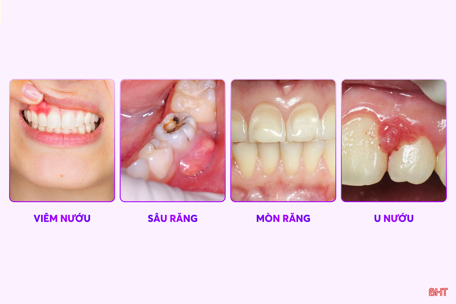 bqbht_br_cac-benh-ly-6599.png