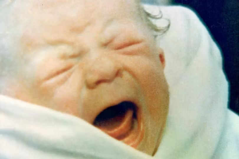 Louise Joy Brown được sinh bằng phương pháp mổ lấy thai ngày 25/7/1978 tại Bệnh viện Đa khoa Oldham, Lancashire, Anh. Ảnh: Keystone/Getty.