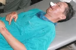 Phó khoa Ngoại tổng hợp BVĐK Hà Tĩnh bị đồng nghiệp đánh “hội đồng”