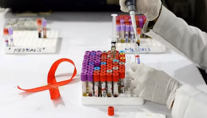 tim ra khang the giet duoc 99 chung virus hiv