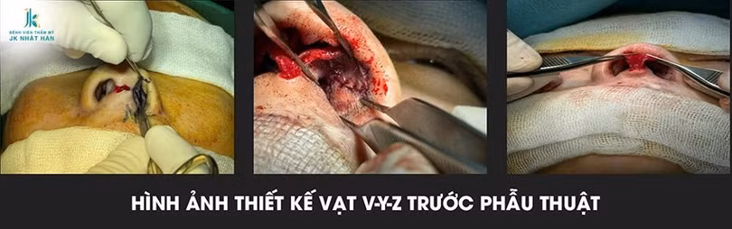 Lê Viết Trí 4.jpg