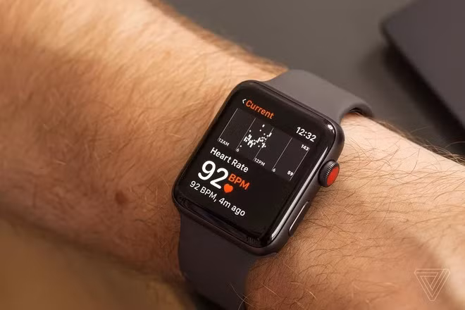 Quá nhiều người đến bệnh viện vì Apple Watch
