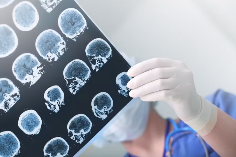 Những lợi ích sức khỏe tuyệt vời của trà xanh