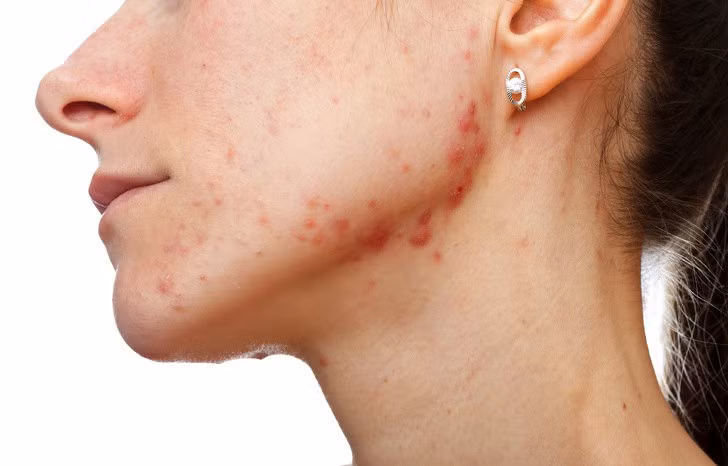 10 thay đổi trong cơ thể tiết lộ tình trạng sức khoẻ của bạn