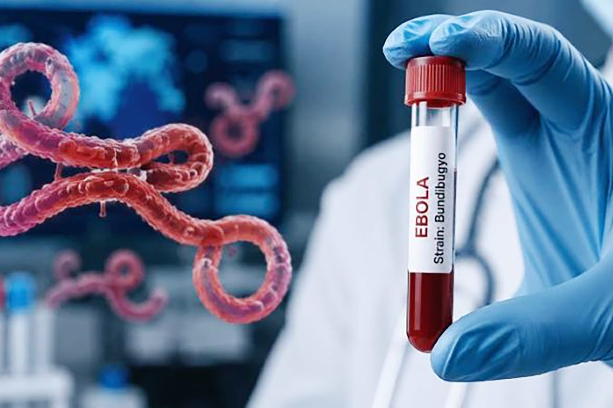 vi-r-t-ebola-l-m-t-b-nh-truy-n-nhi-m-c-p-t-nh-v-nghi-m-tr-ng-ng-i-th-ng-i-k-m-h-i-ch-ng-xu-t-huy-t-v-suy-a-t-ng-t-l-t-vong-c-th-l-n-n-9.jpg