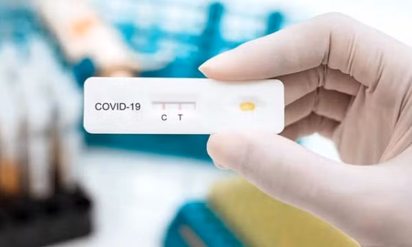 Có hiện tượng đầu cơ, tăng giá bộ sinh phẩm xét nghiệm SARS-CoV-2