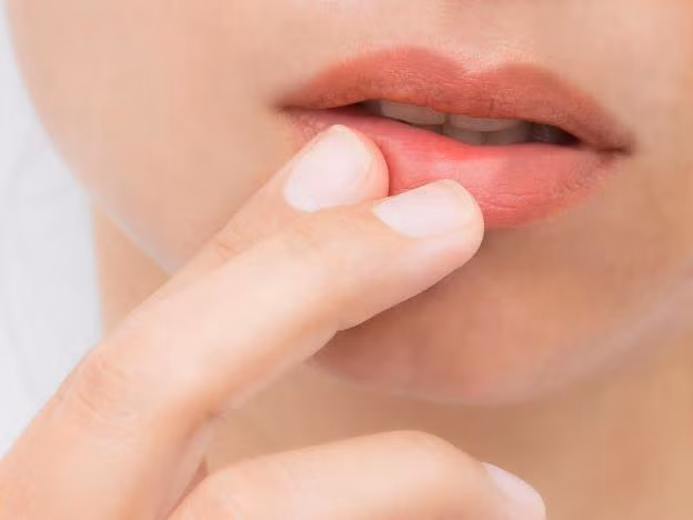 Cấp cứu đôi môi nứt nẻ mùa hanh khô