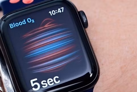 Xiaomi, Apple dẫn đầu thị trường thiết bị đeo tại Việt Nam ảnh 1 Xiaomi, Apple dẫn đầu thị trường thiết bị đeo tại Việt Nam