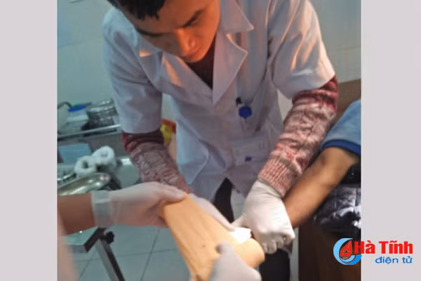 no binh gas mini mot nguoi dan ong bi dap nat ban tay
