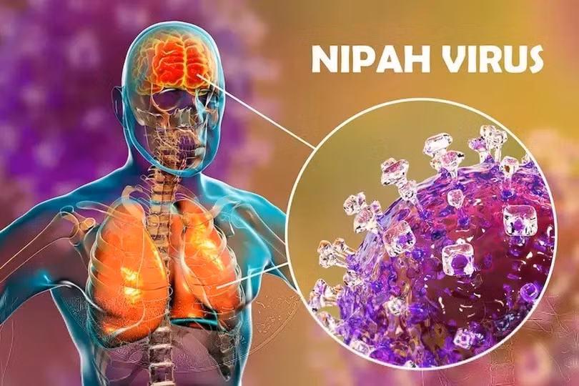 Virus Nipah có thể gây viêm hô hấp, viêm não dẫn đến tử vong. Ảnh: Getty