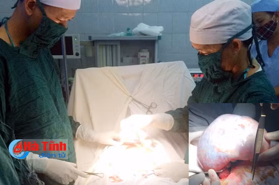 cat khoi u nang 3 5 kg cho benh nhan cao tuoi