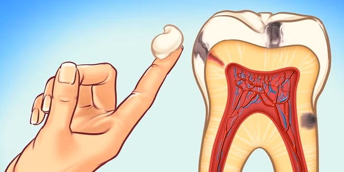 Nghe nha sĩ tiết lộ các cách đơn giản ai cũng có thể làm để ngăn ngừa sâu răng