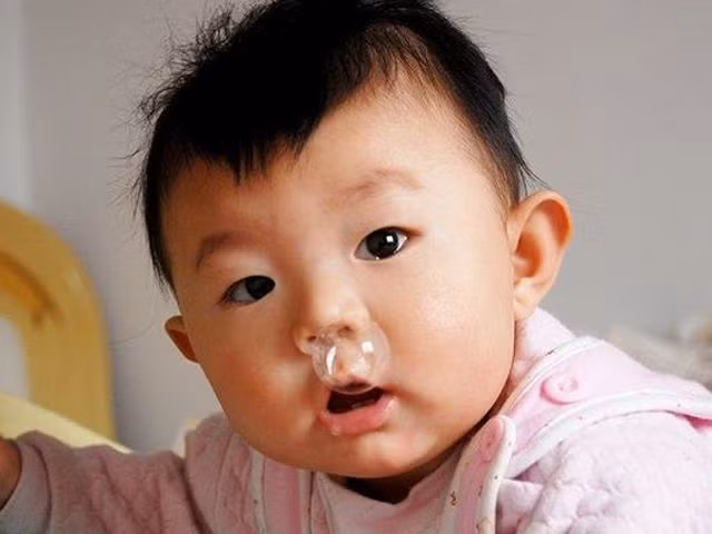 Trẻ vài bữa lại sổ mũi một lần, là bệnh gì?