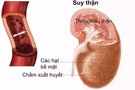 mat nuoc va nhung nguy co tiem an
