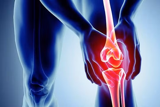 Vì sao dễ bị thoái hóa khớp?