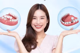 Nền tảng số giúp người tiêu dùng dễ dàng tiếp cận thông tin nha khoa