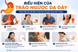 7 dấu hiệu trào ngược dạ dày - thực quản không nên chủ quan: Khi nào cần nội soi dạ dày?