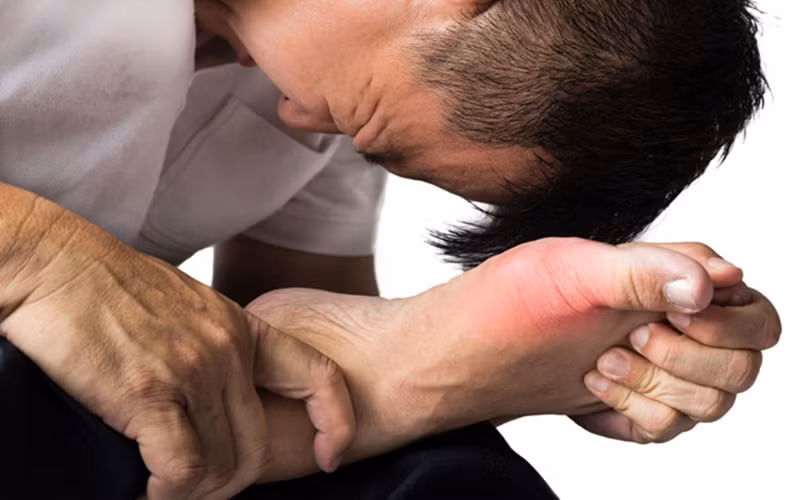 Những nguyên nhân làm tăng nguy cơ mắc bệnh gút