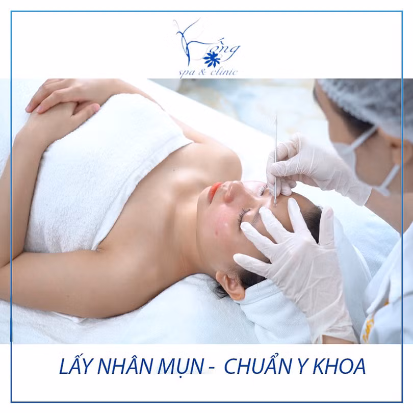 Spa trị sẹo cho nam nào hiệu quả nhất?